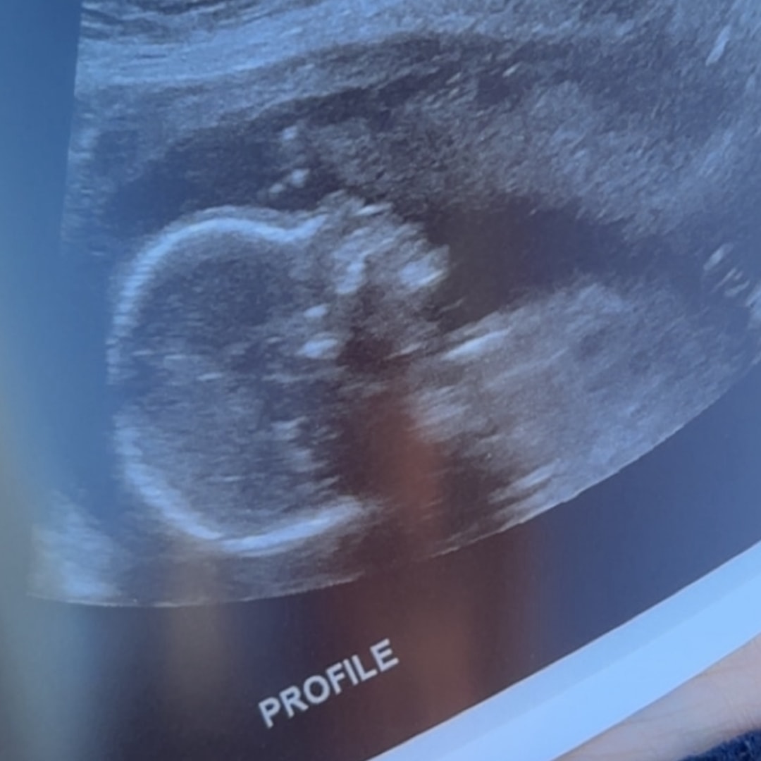 Photo shared by Briana for their Babylist baby registry.