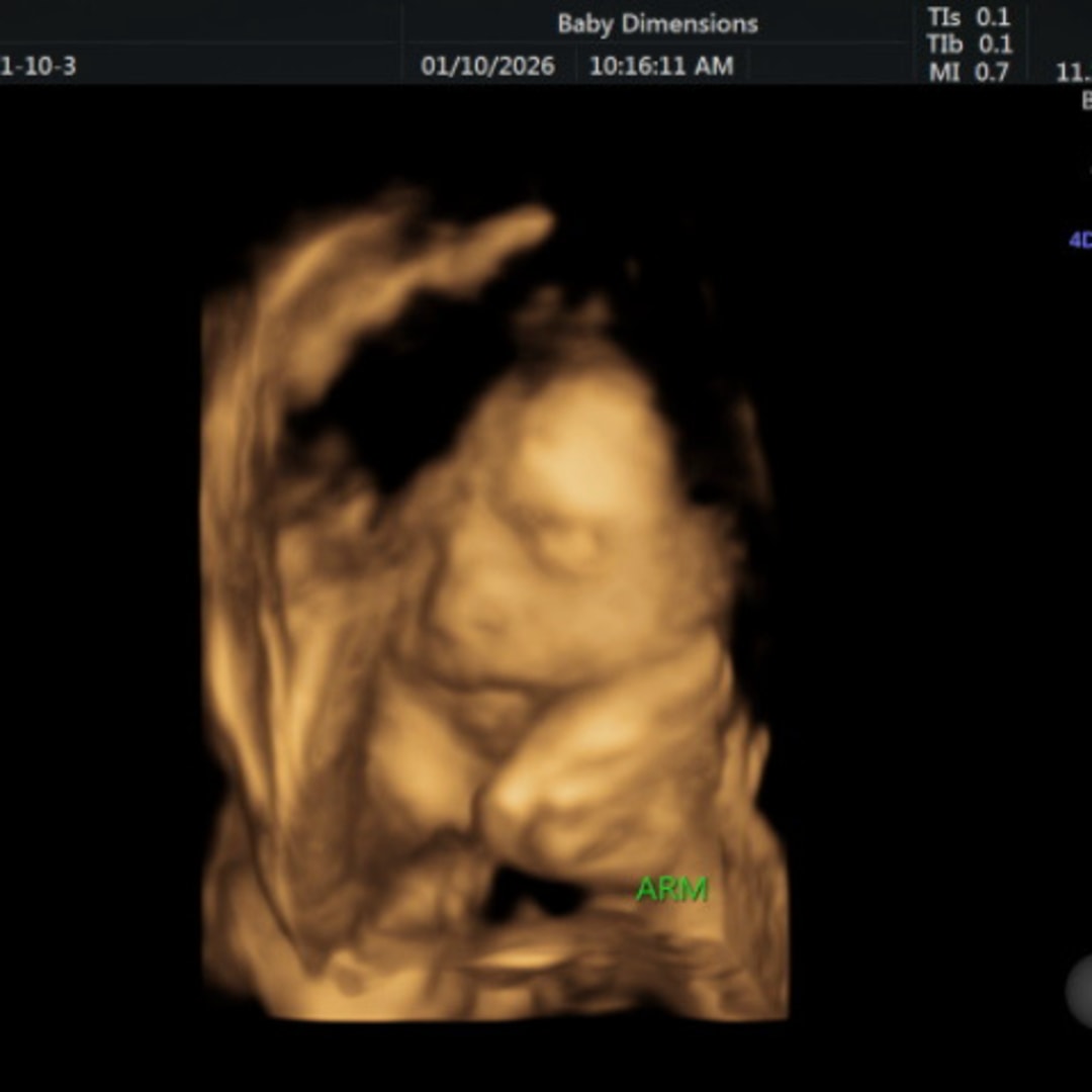 Photo shared by Emily for their Babylist baby registry.