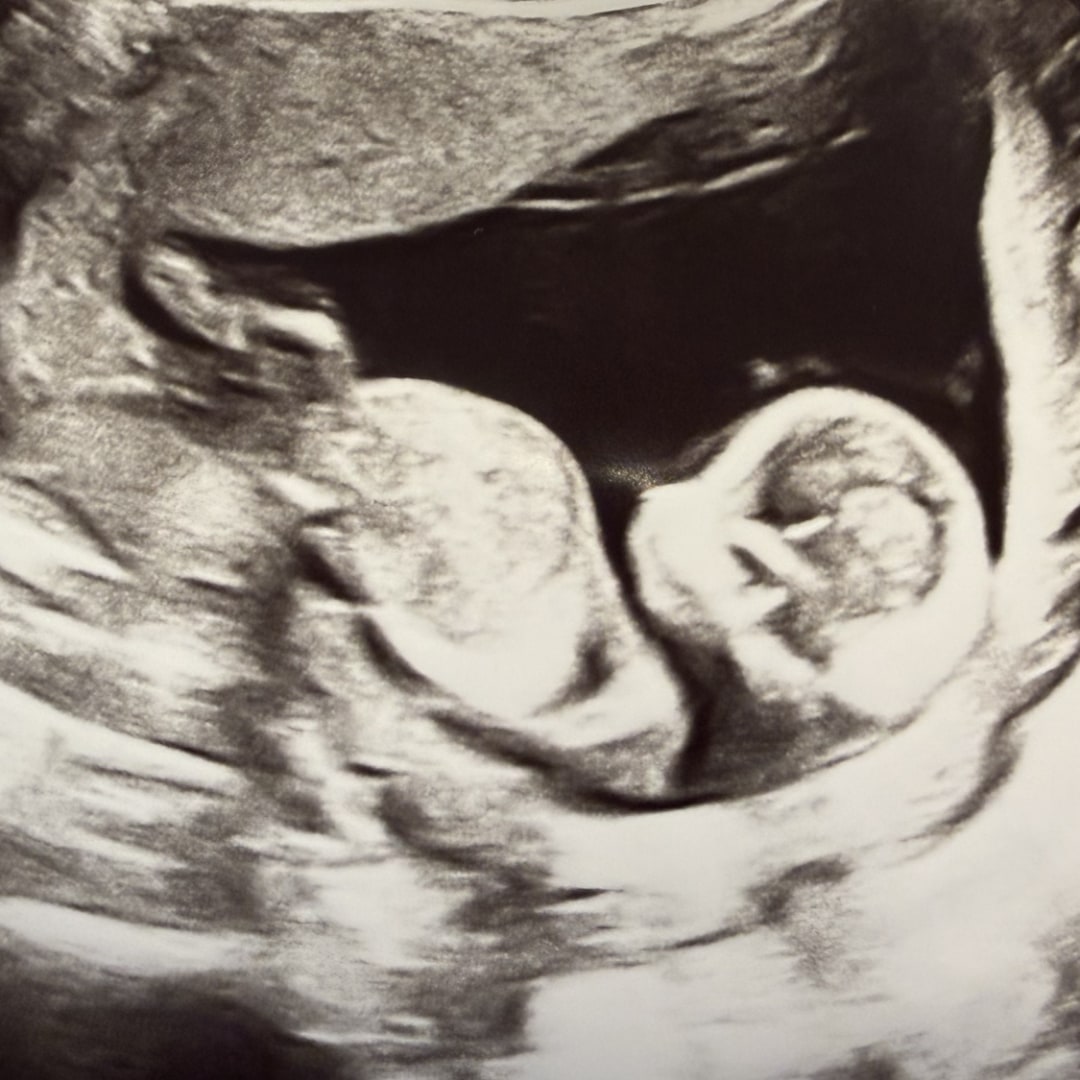 Photo shared by Breanna for their Babylist baby registry.