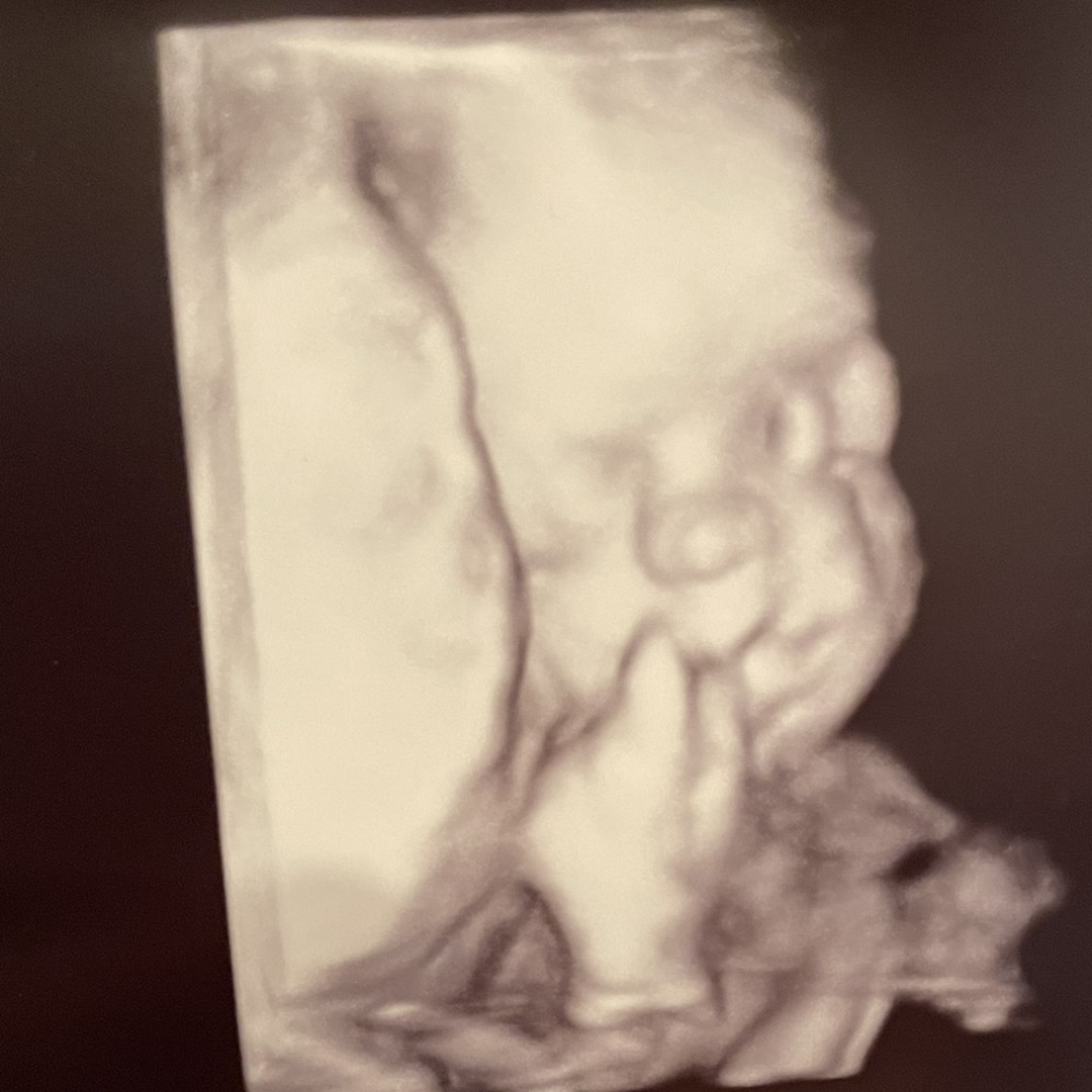 Photo shared by Anna for their Babylist baby registry.