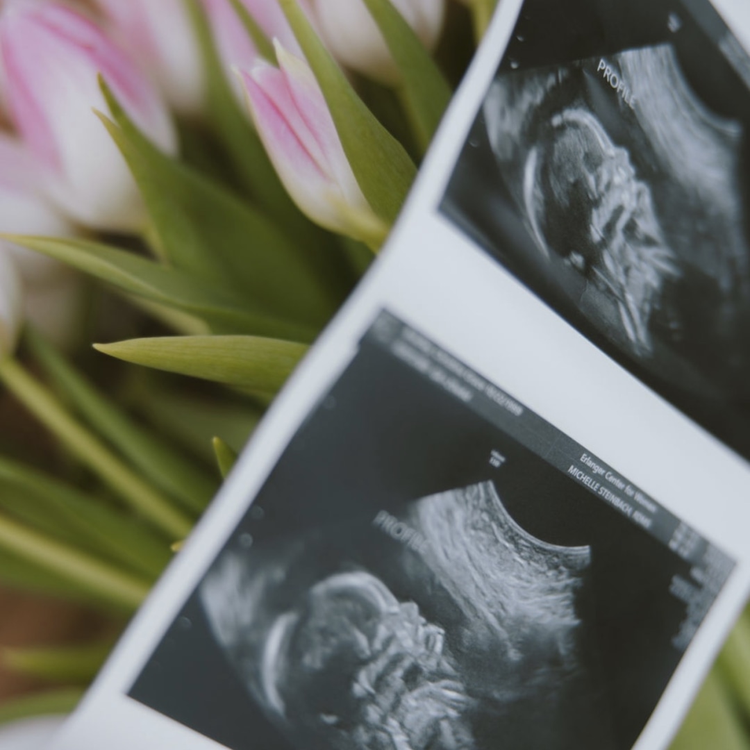 Photo shared by Christina for their Babylist baby registry.