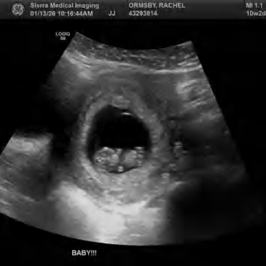 Photo shared by Rachel for their Babylist baby registry.