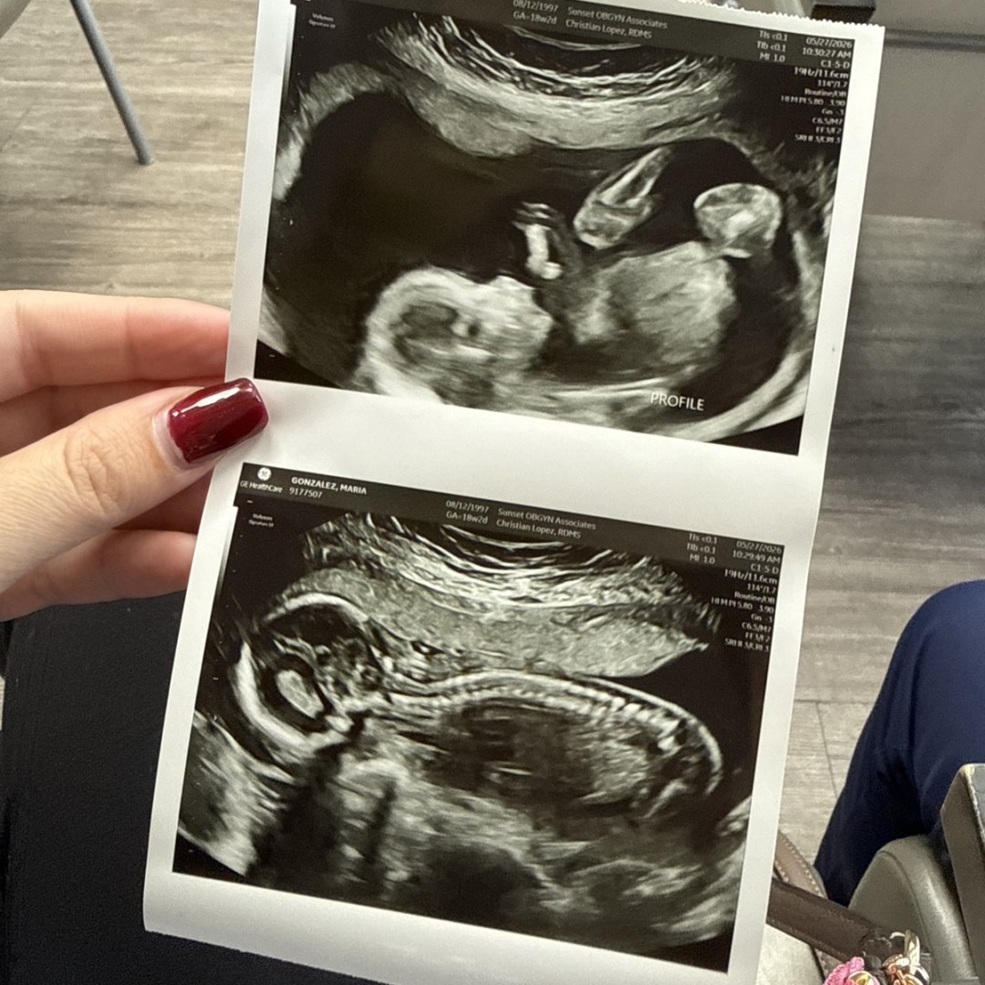 Photo shared by Fabiola for their Babylist baby registry.