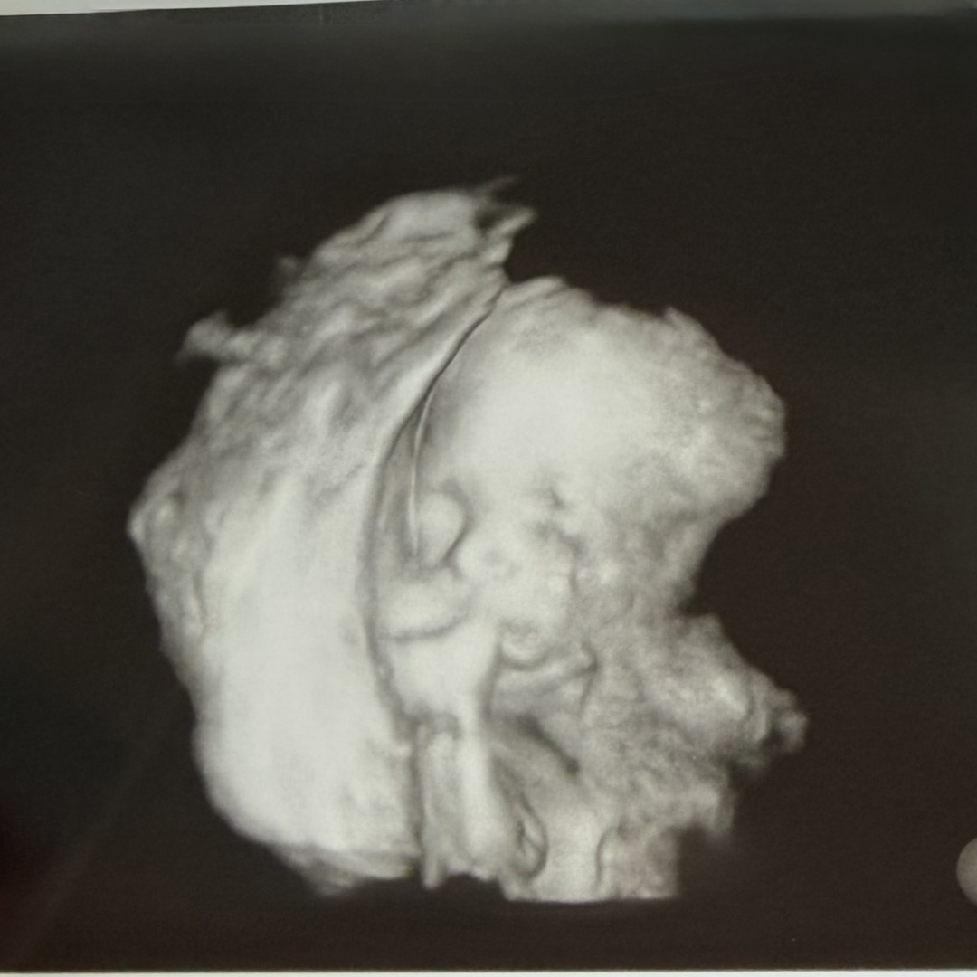 Photo shared by Ashley for their Babylist baby registry.