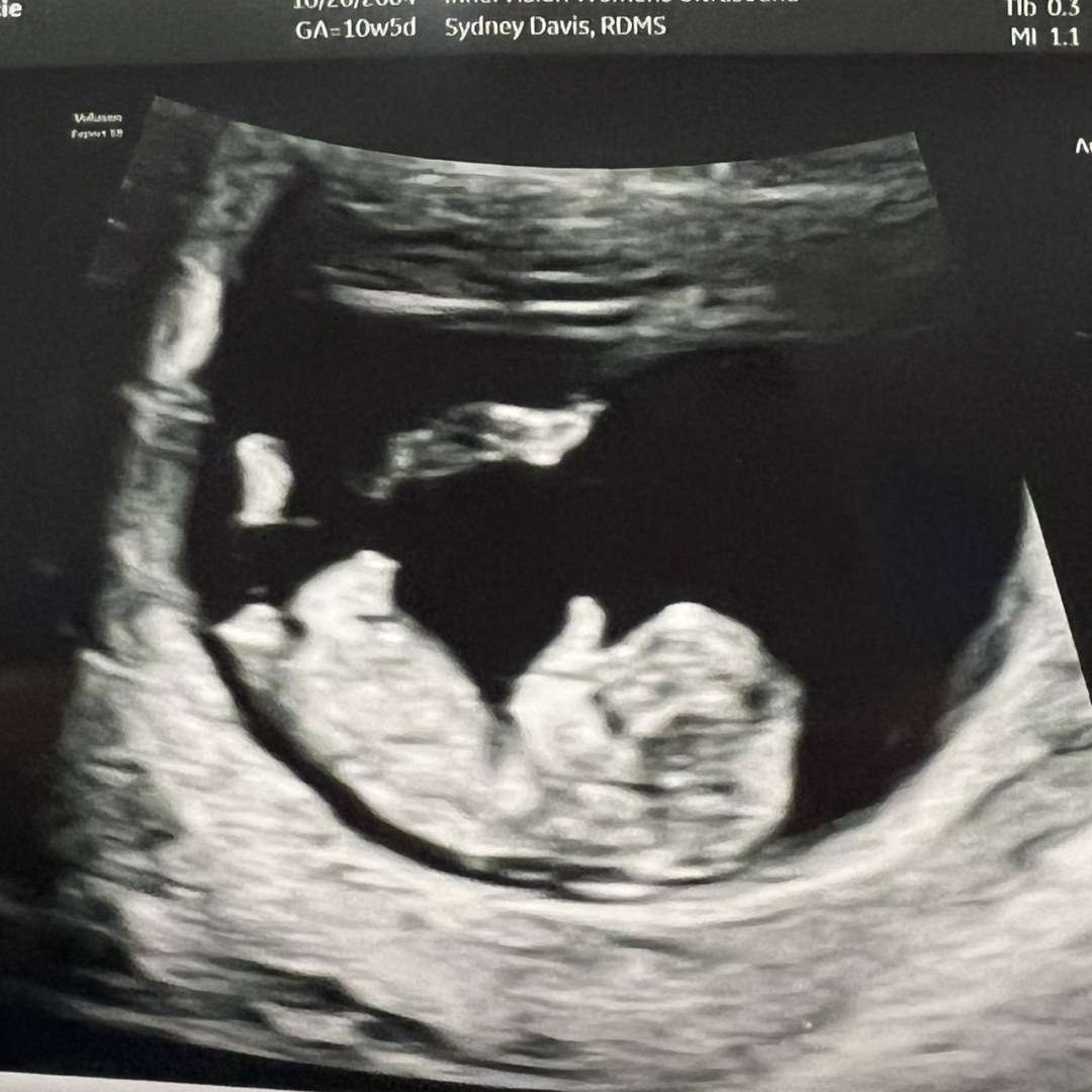 Photo shared by Gracie for their Babylist baby registry.