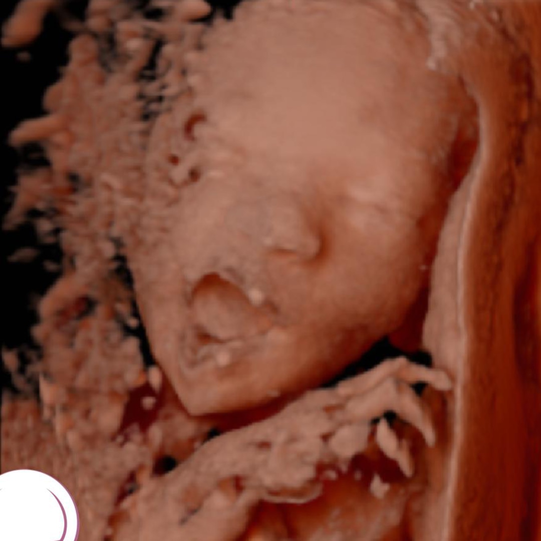 Photo shared by Chrisbel for their Babylist baby registry.