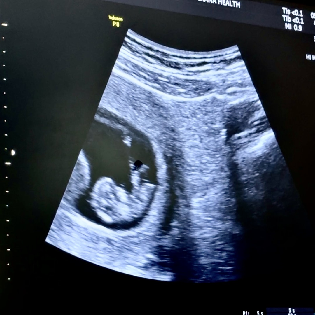Photo shared by Anna for their Babylist baby registry.