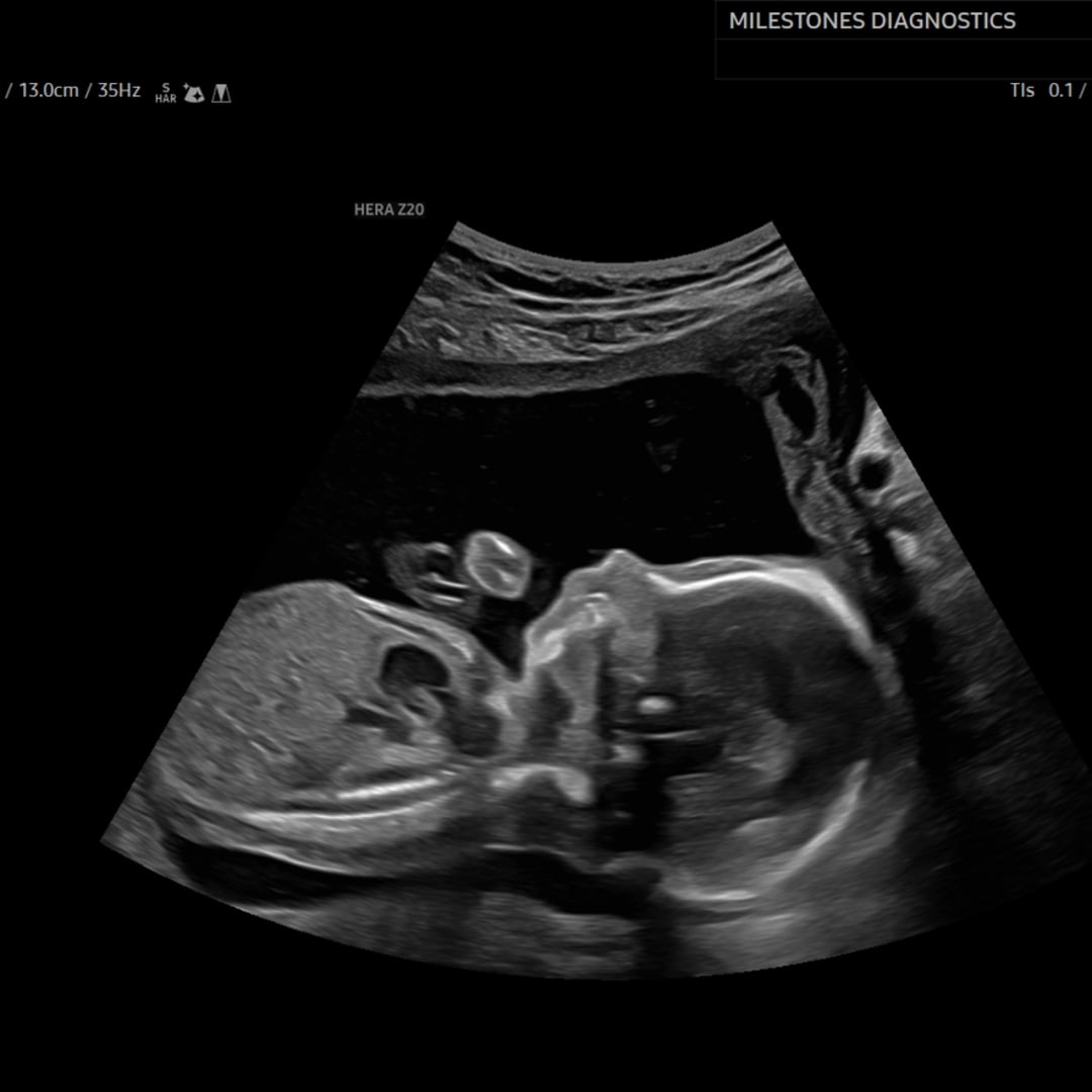 Photo shared by Charlotte for their Babylist baby registry.