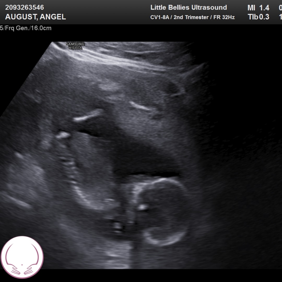Photo shared by Angel for their Babylist baby registry.
