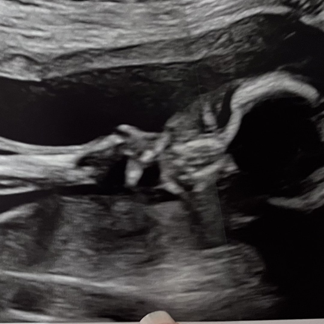 Photo shared by Megan for their Babylist baby registry.