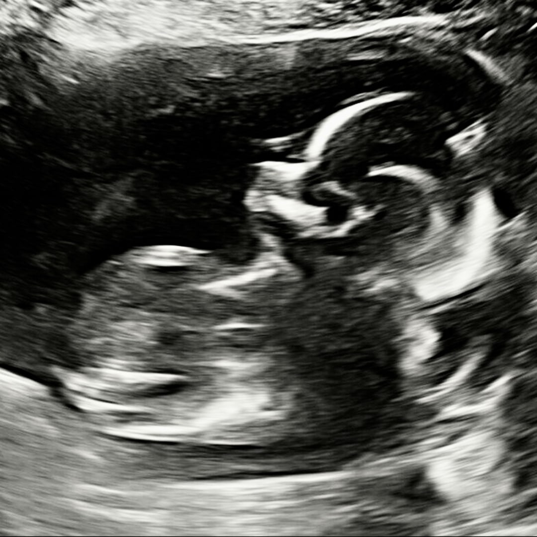 Photo shared by Kelly for their Babylist baby registry.