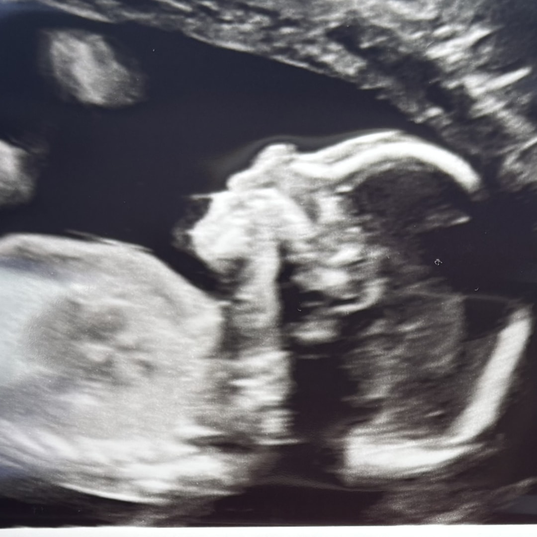 Photo shared by Jillian for their Babylist baby registry.