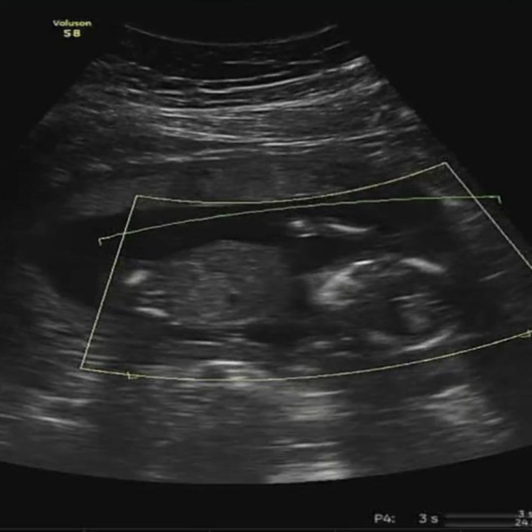 Photo shared by Katie for their Babylist baby registry.