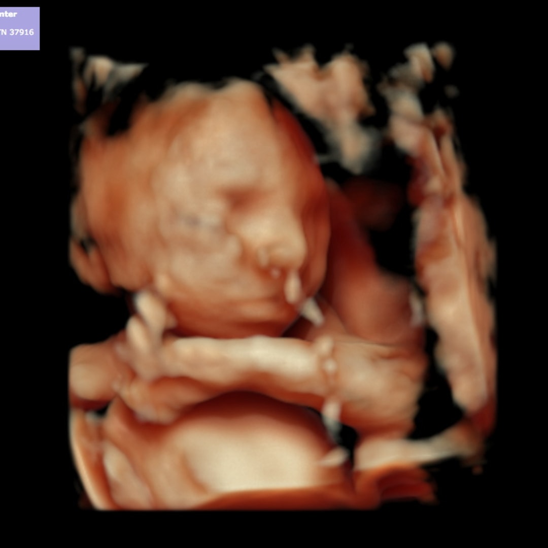 Photo shared by Kelby for their Babylist baby registry.