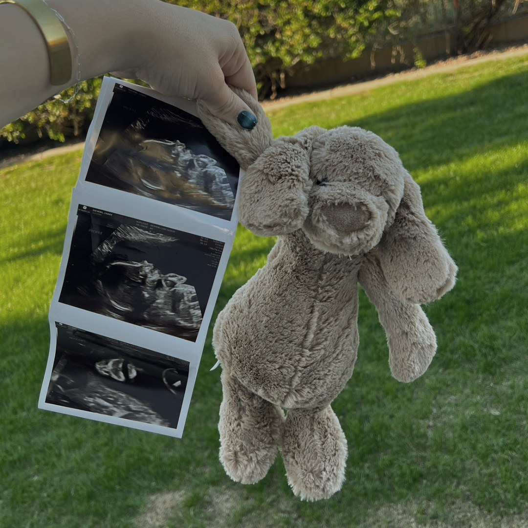 Photo shared by Zaidee for their Babylist baby registry.