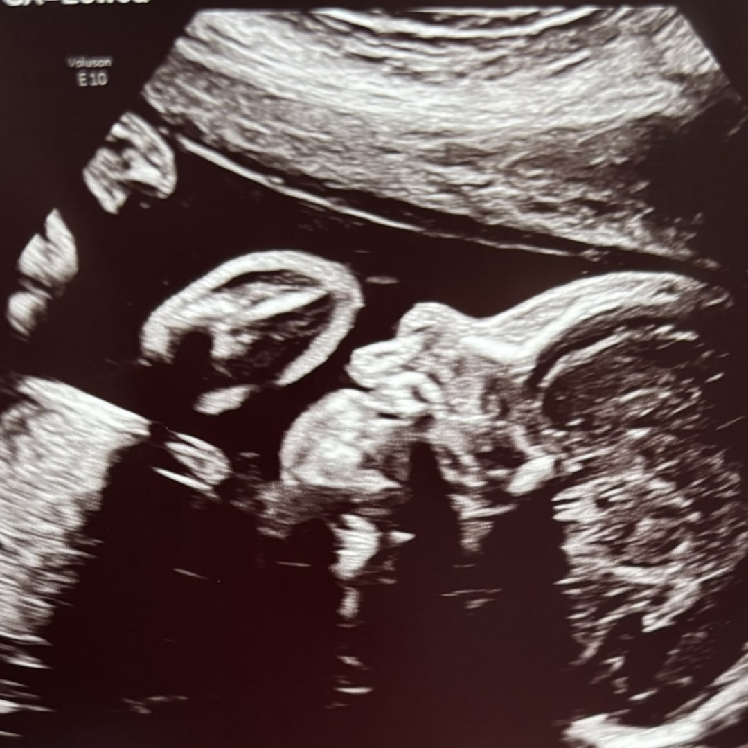 Photo shared by Chelzi for their Babylist baby registry.