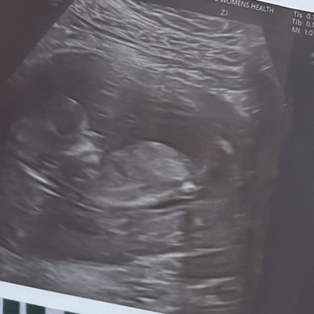 Photo shared by Natalia for their Babylist baby registry.