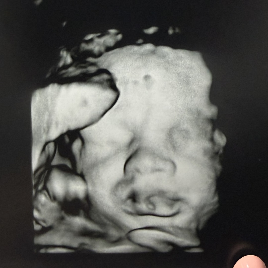 Photo shared by Brianna for their Babylist baby registry.
