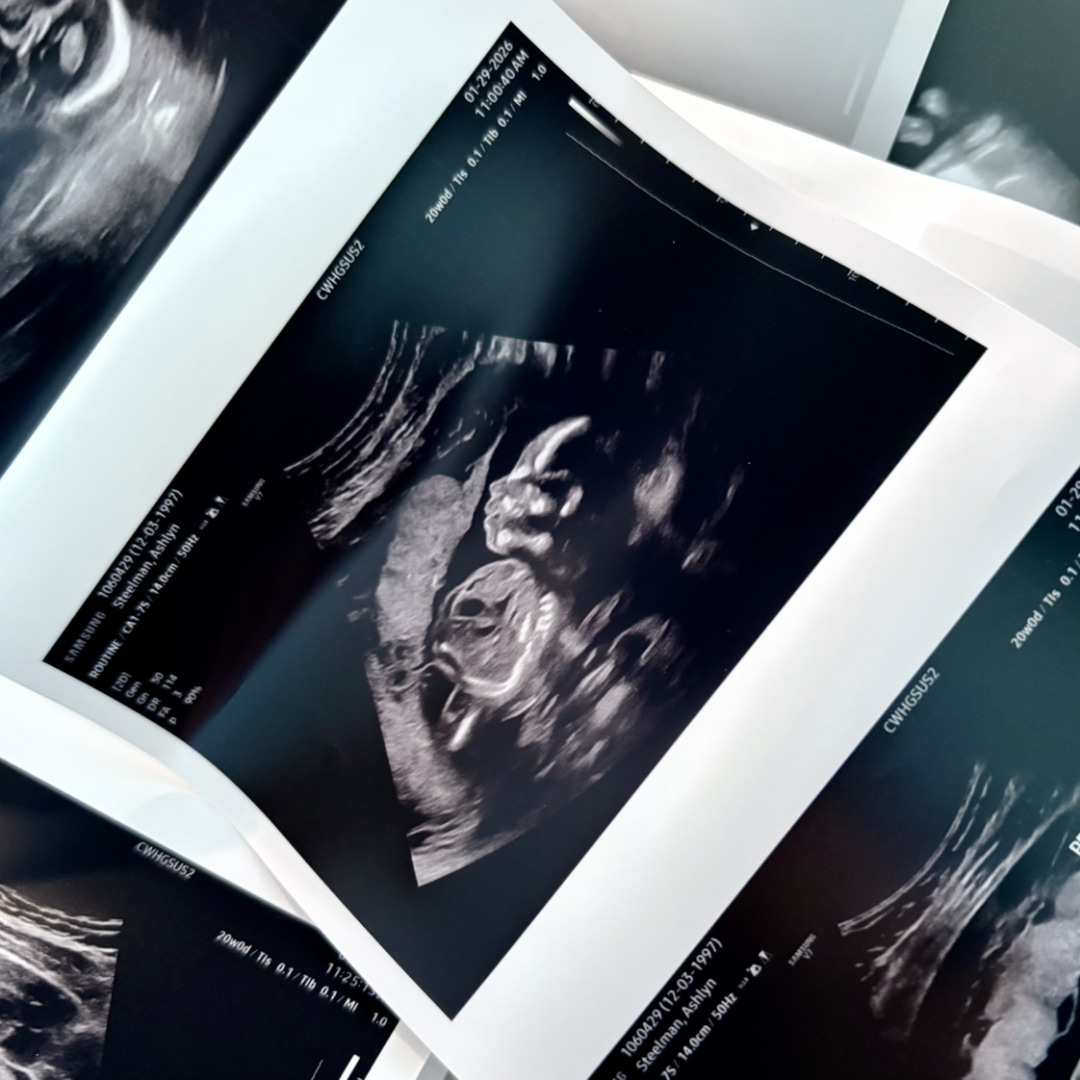 Photo shared by Ashlyn for their Babylist baby registry.