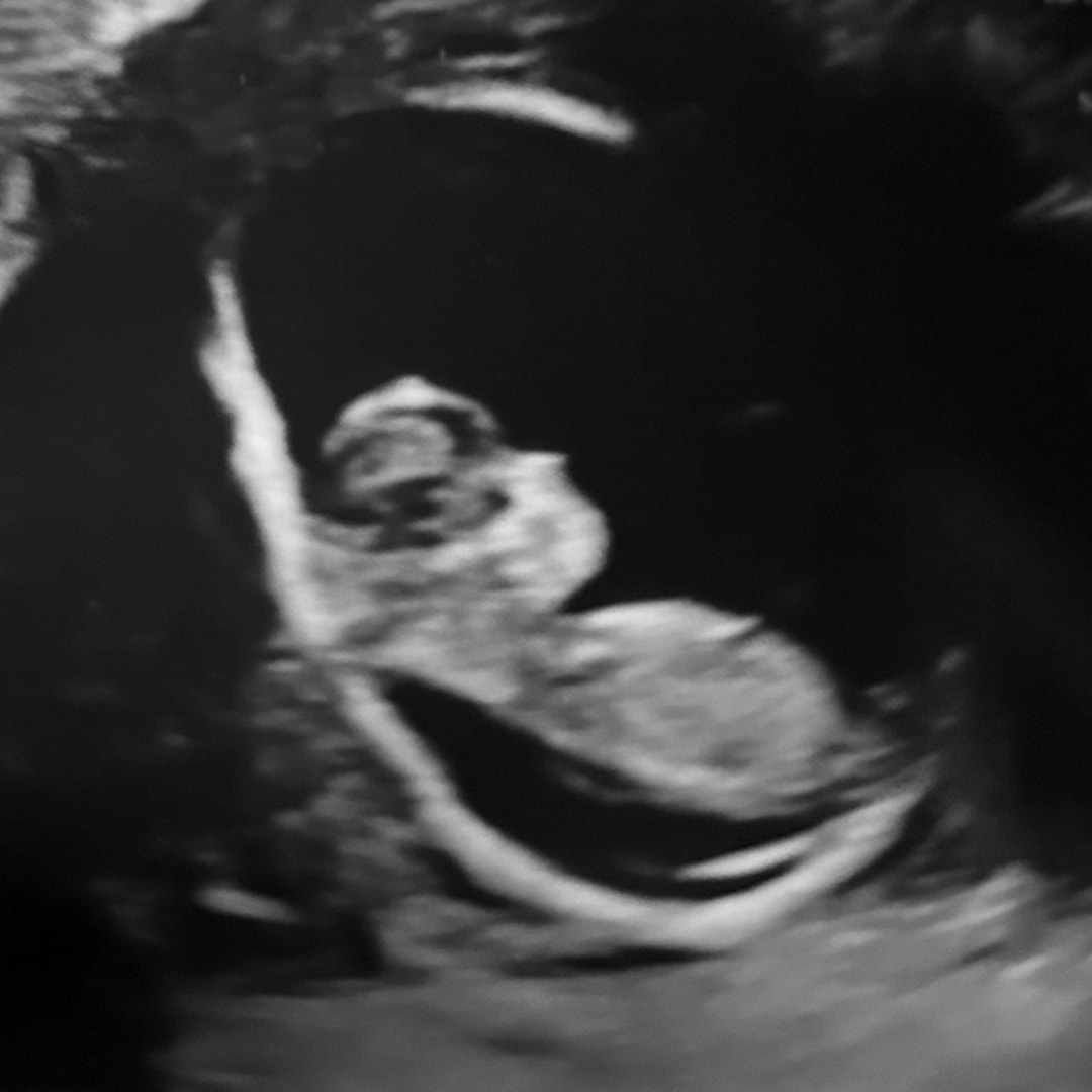 Photo shared by Faith for their Babylist baby registry.