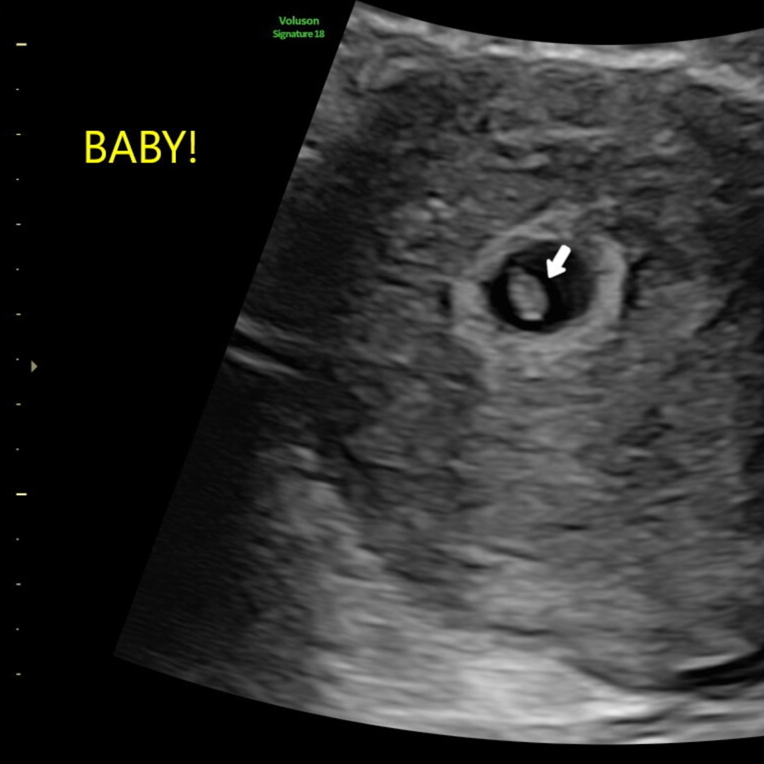 Photo shared by Makenzy for their Babylist baby registry.