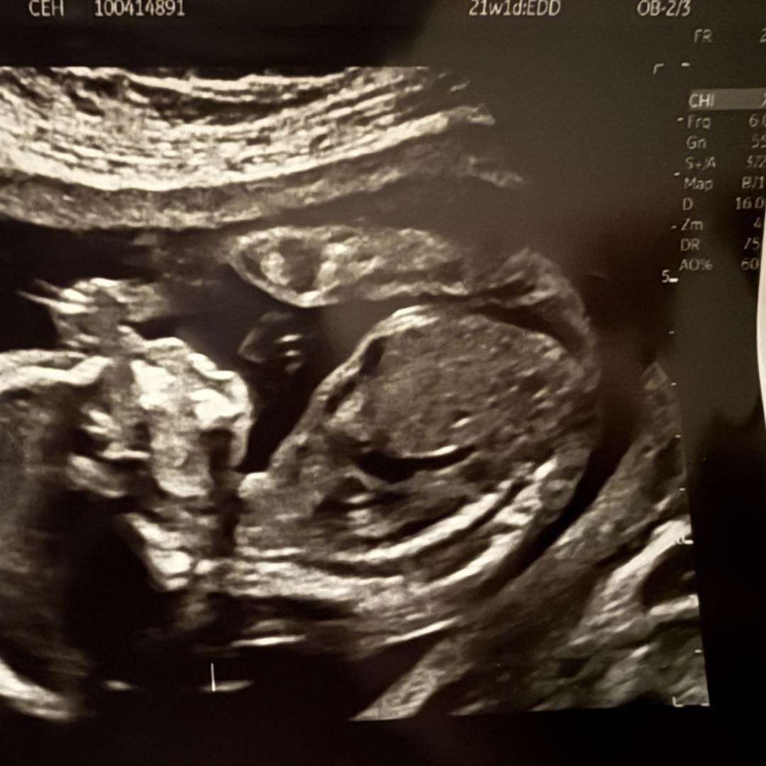 Photo shared by Alexis for their Babylist baby registry.