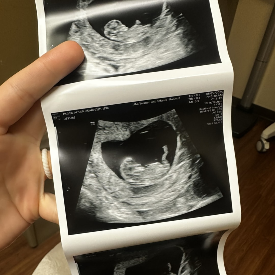 Photo shared by Alison for their Babylist baby registry.