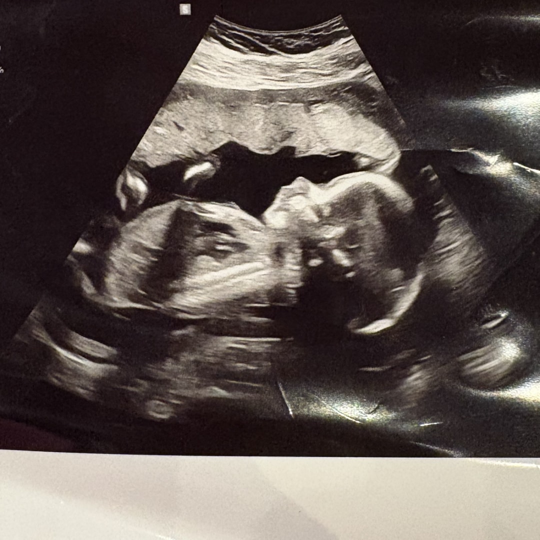 Photo shared by Anika for their Babylist baby registry.