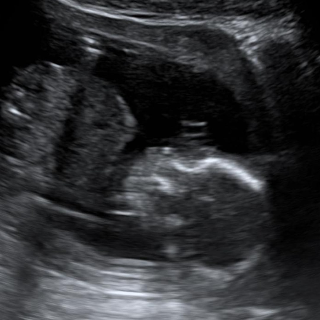 Photo shared by Aleeya for their Babylist baby registry.