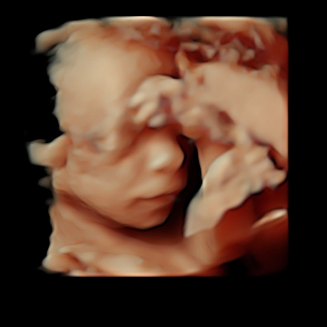 Photo shared by Jeshua for their Babylist baby registry.