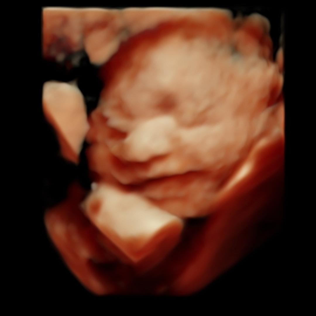 Photo shared by Yeilyn for their Babylist baby registry.
