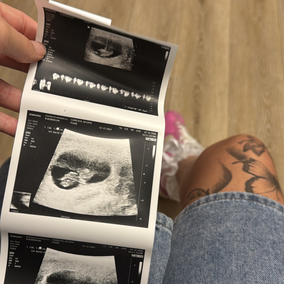 Photo shared by Vaya for their Babylist baby registry.