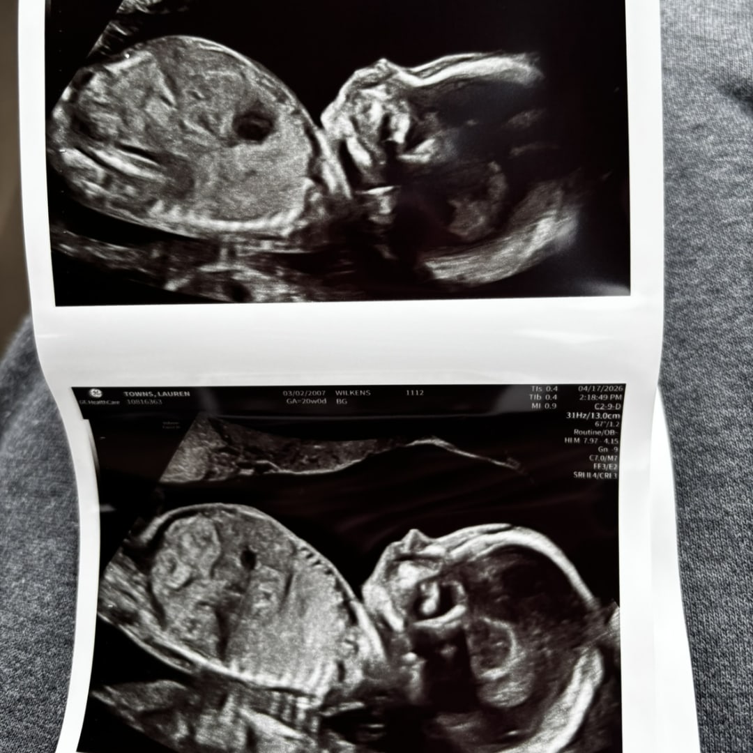 Photo shared by Lauren for their Babylist baby registry.