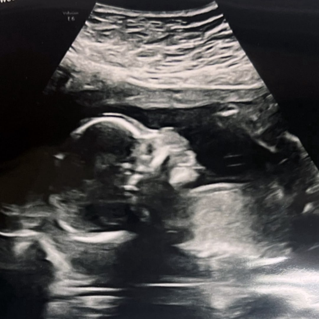 Photo shared by Chyan for their Babylist baby registry.