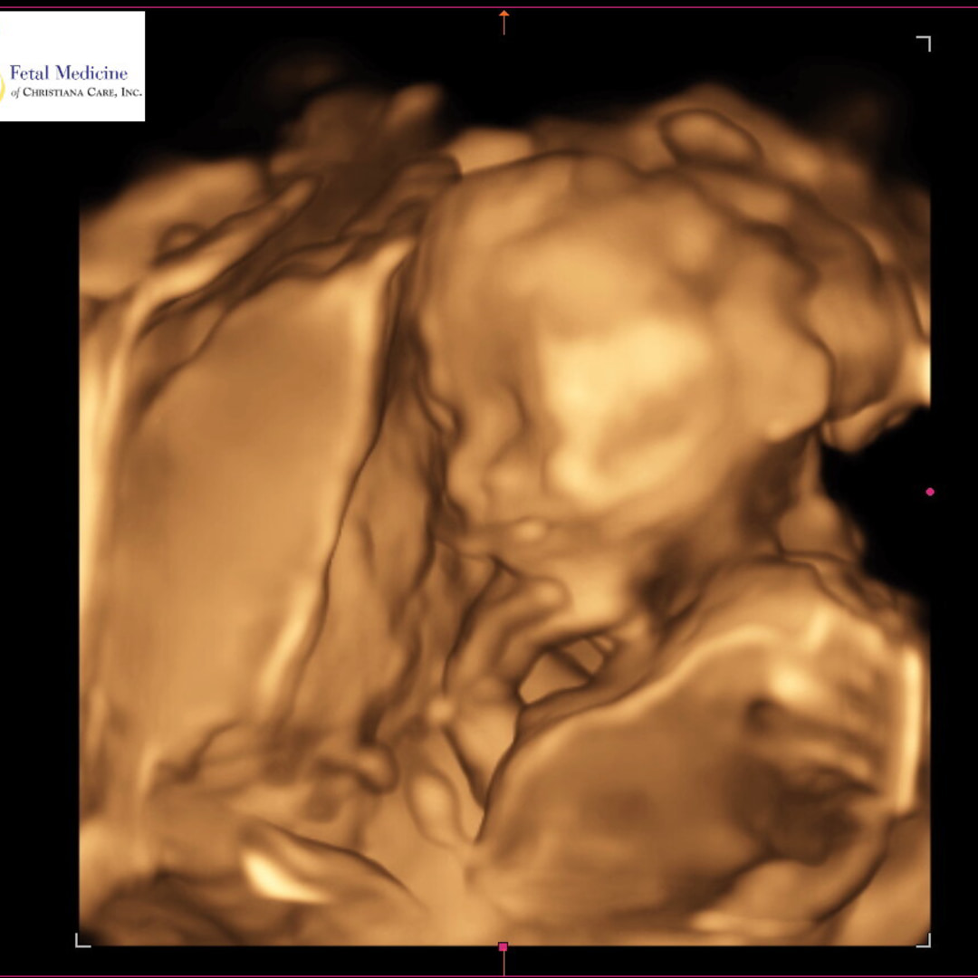 Photo shared by Mackenzie for their Babylist baby registry.