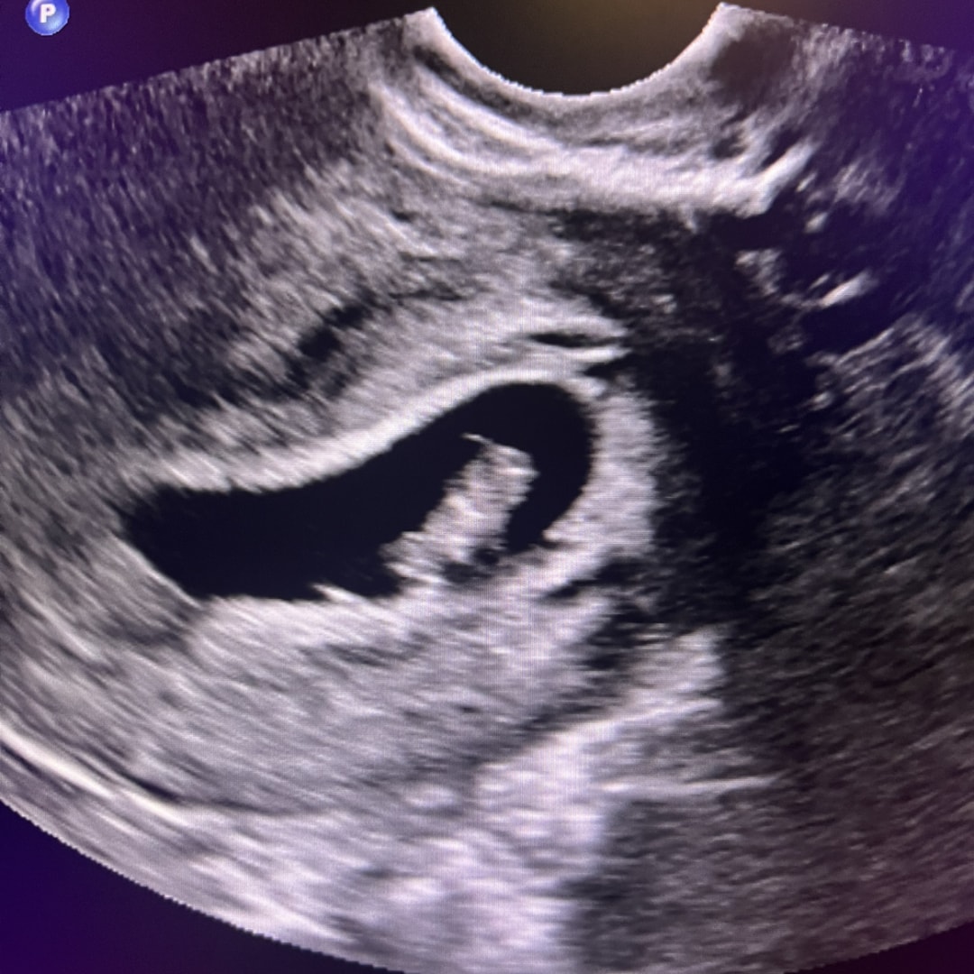 Photo shared by Stephanie for their Babylist baby registry.