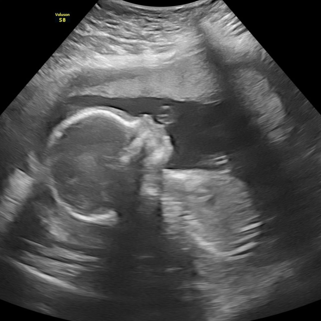 Photo shared by Jessica for their Babylist baby registry.