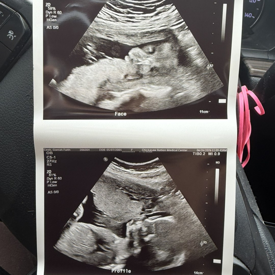 Photo shared by Siarrah for their Babylist baby registry.