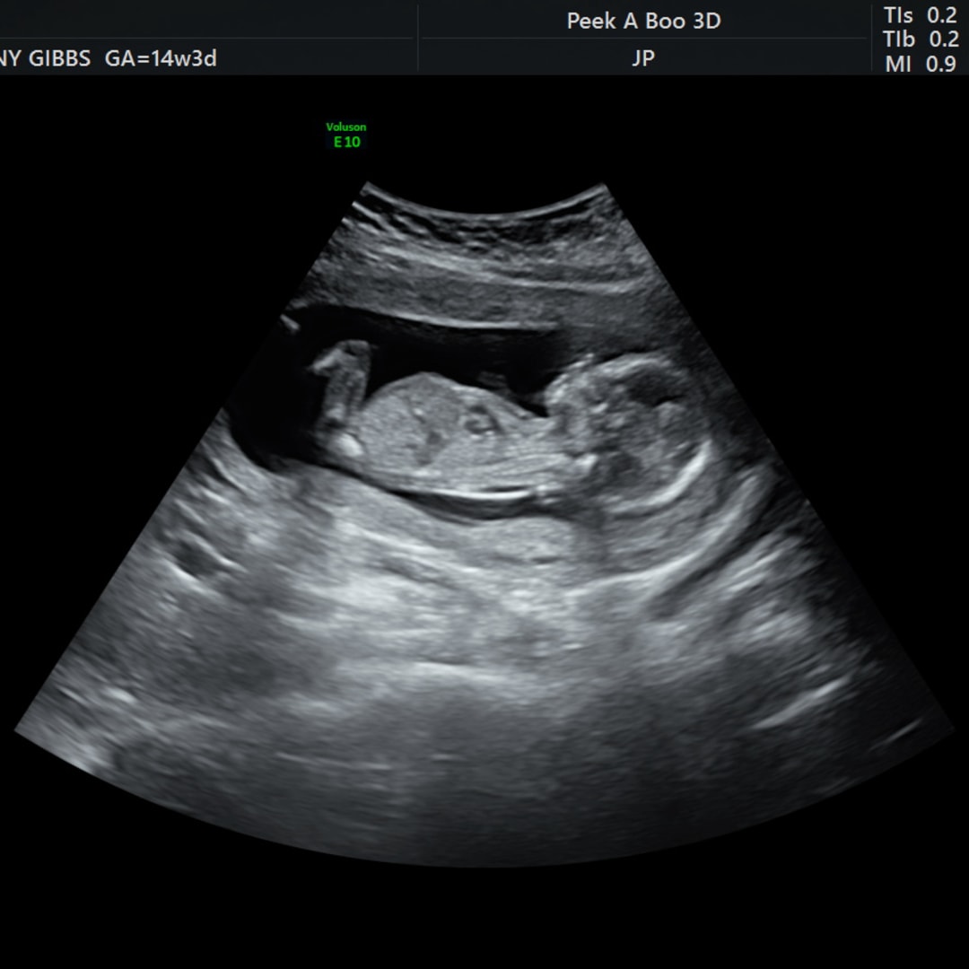 Photo shared by Britany for their Babylist baby registry.