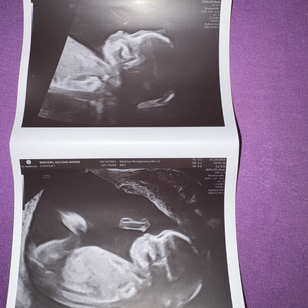 Photo shared by Kalisha for their Babylist baby registry.