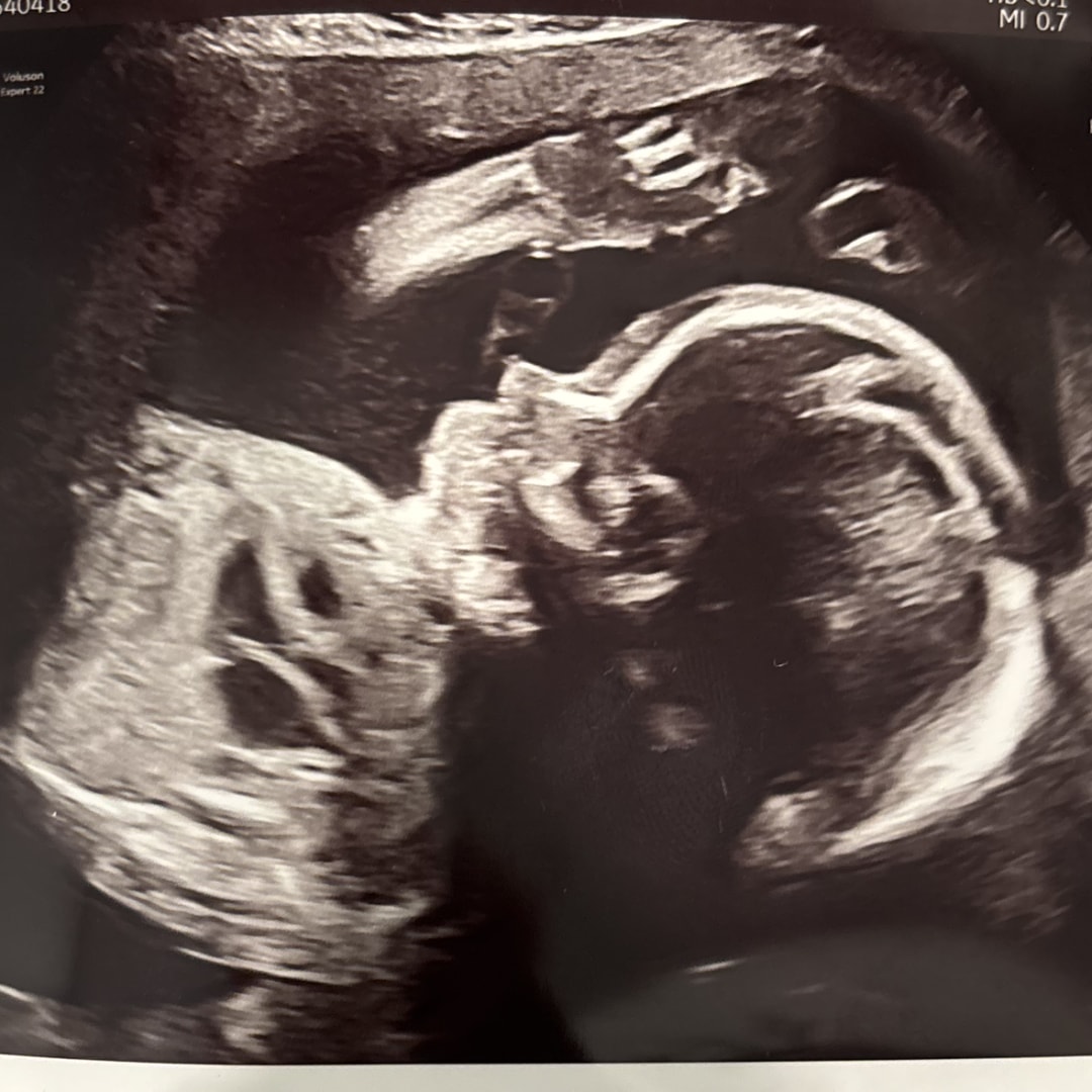 Photo shared by Emily for their Babylist baby registry.