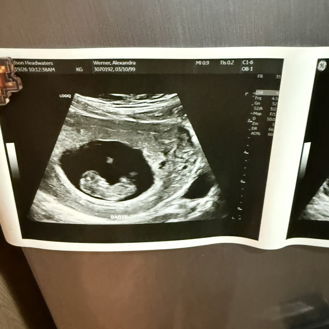 Photo shared by Alexandra for their Babylist baby registry.