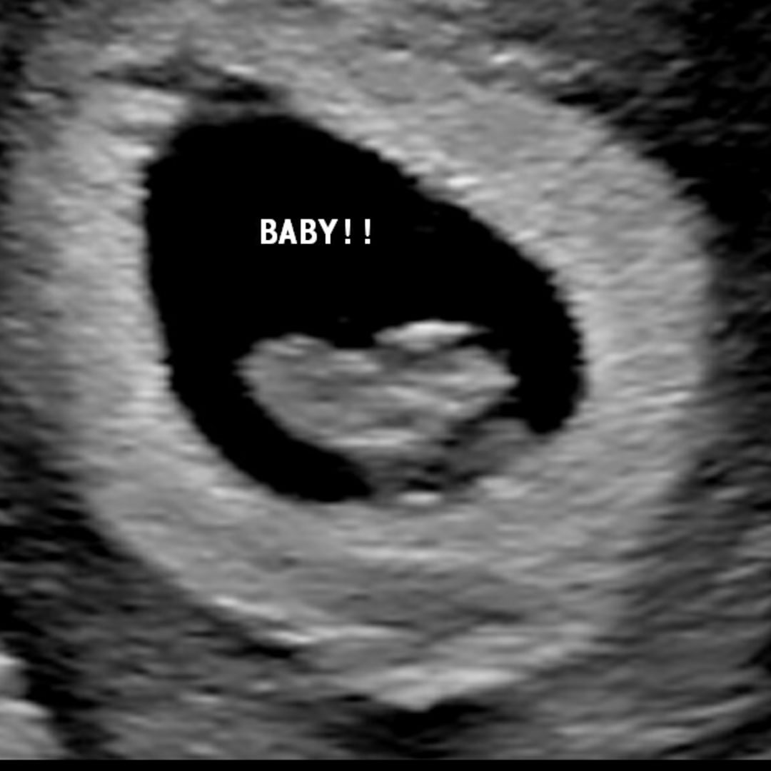 Photo shared by Bailey for their Babylist baby registry.