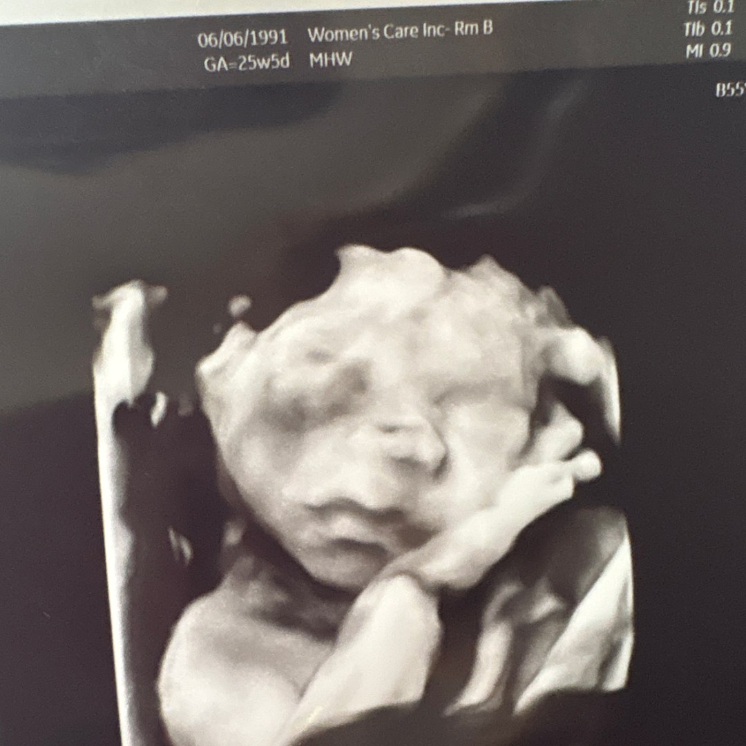Photo shared by Keira for their Babylist baby registry.