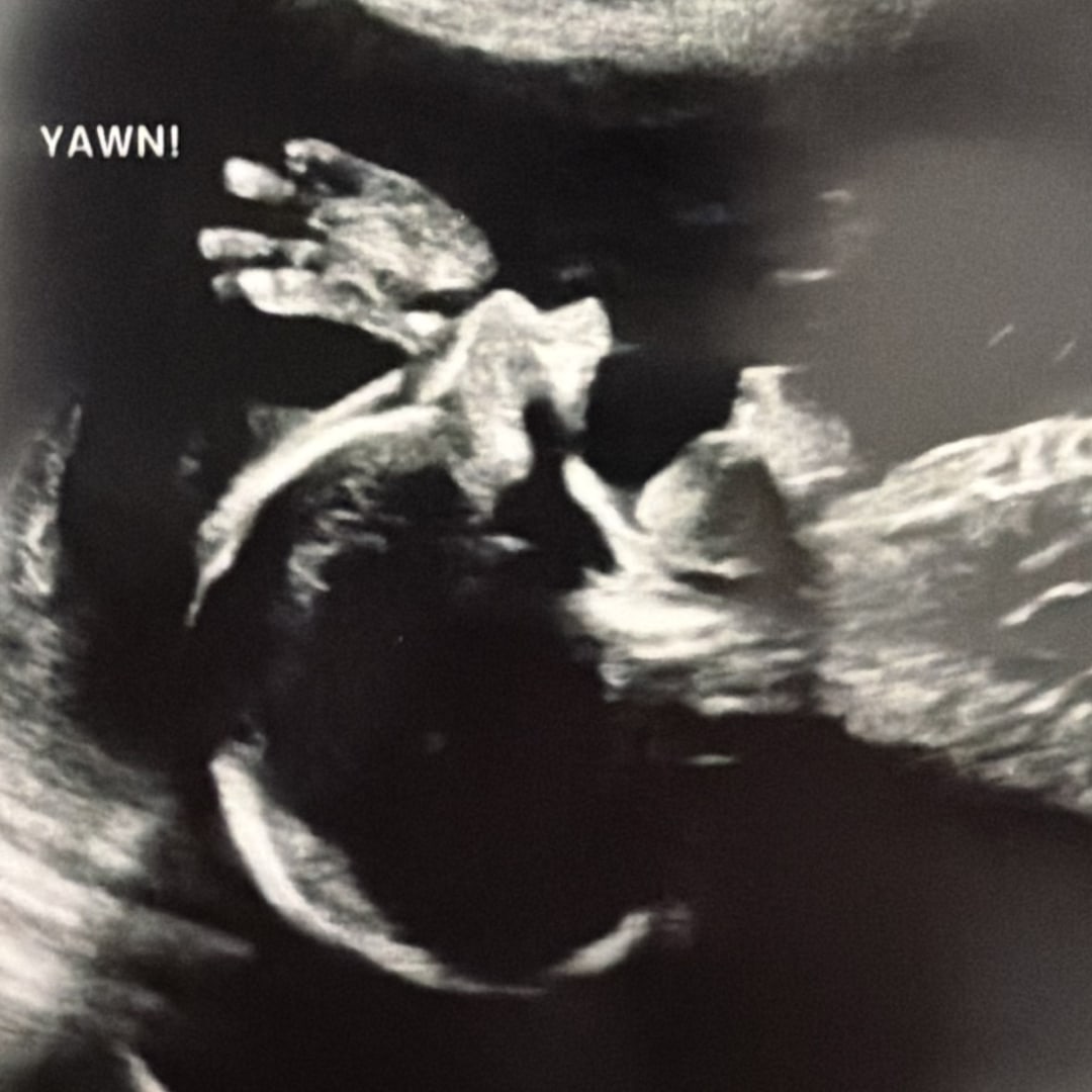 Photo shared by Shania for their Babylist baby registry.