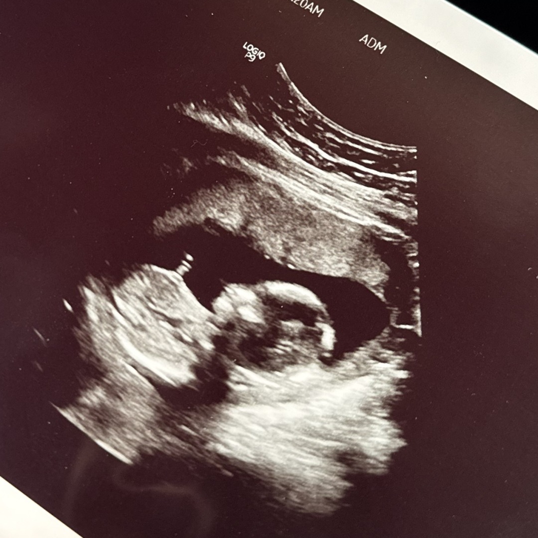Photo shared by Esmeralda for their Babylist baby registry.