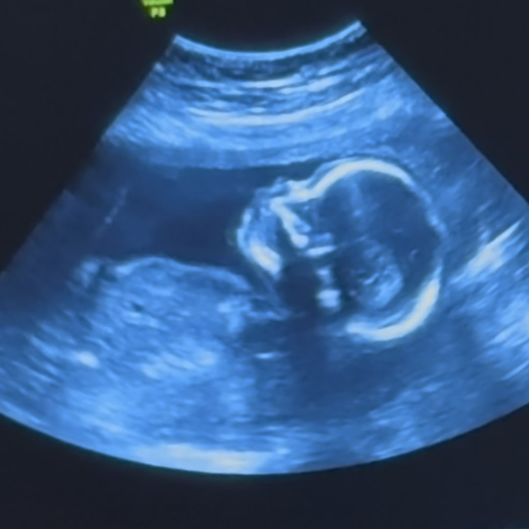 Photo shared by Mariana for their Babylist baby registry.