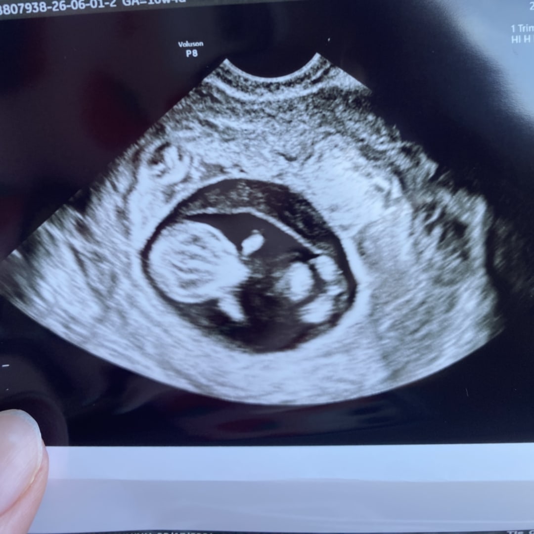 Photo shared by Joseph for their Babylist baby registry.
