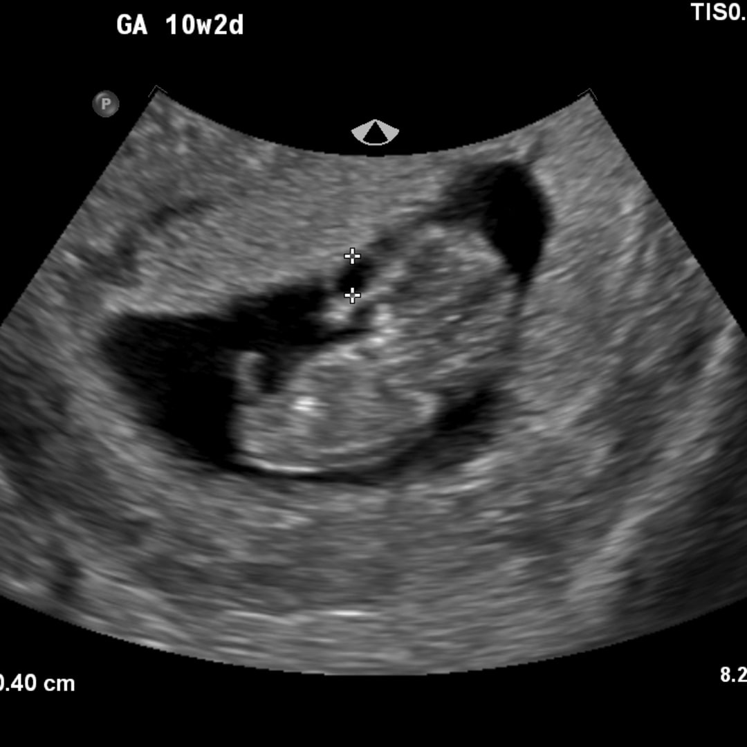 Photo shared by Hailey for their Babylist baby registry.