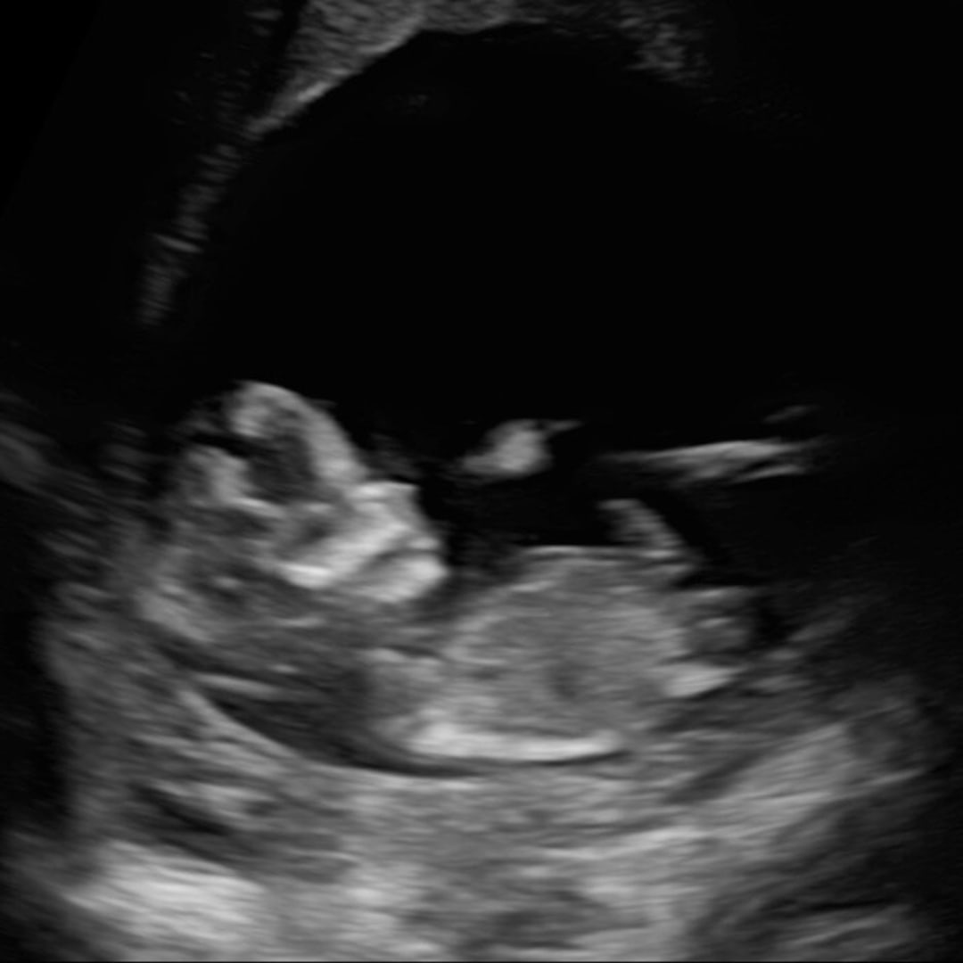 Photo shared by Cassidy for their Babylist baby registry.